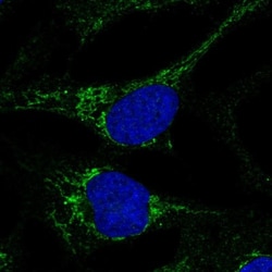MTCP1NB Antibody, Novus Biologicals 25 &mu;L | Buy Online | Novus Biologicals | Fisher Scientific